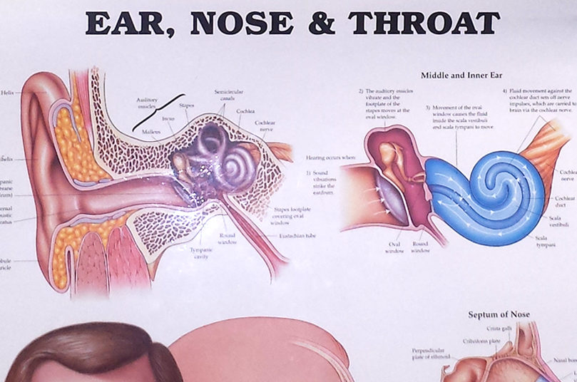 Ear Nose & Throat Chart with Eardrum while I was sick