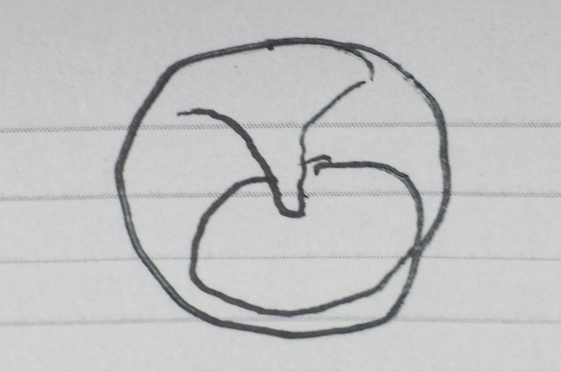 Eardrum picture drawn by my doctor while sick